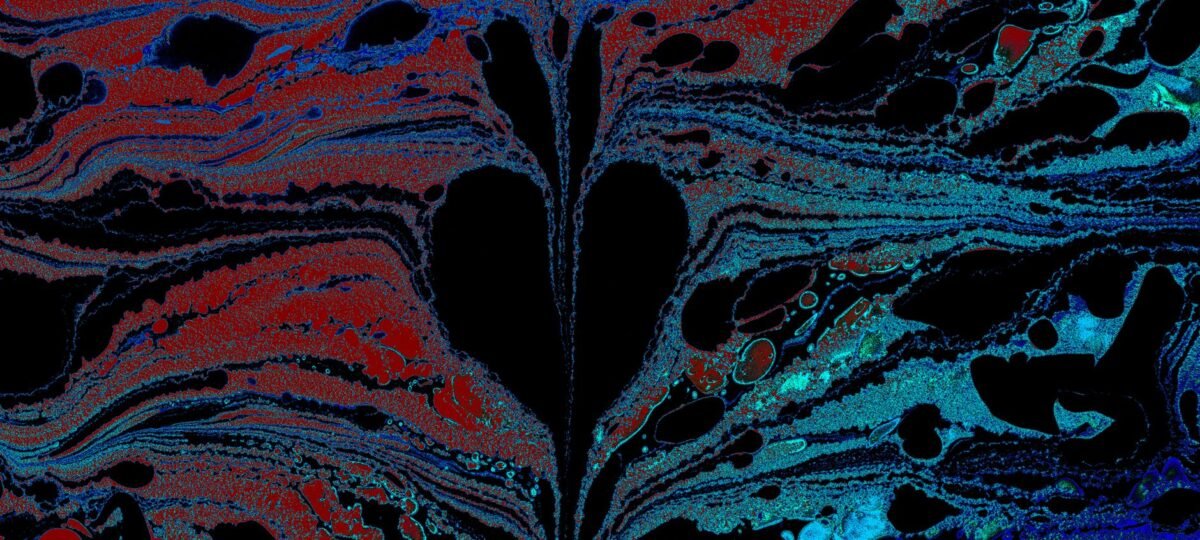 My Heart Bleeds: When Love Dies Because He Didn’t Believe My Cause